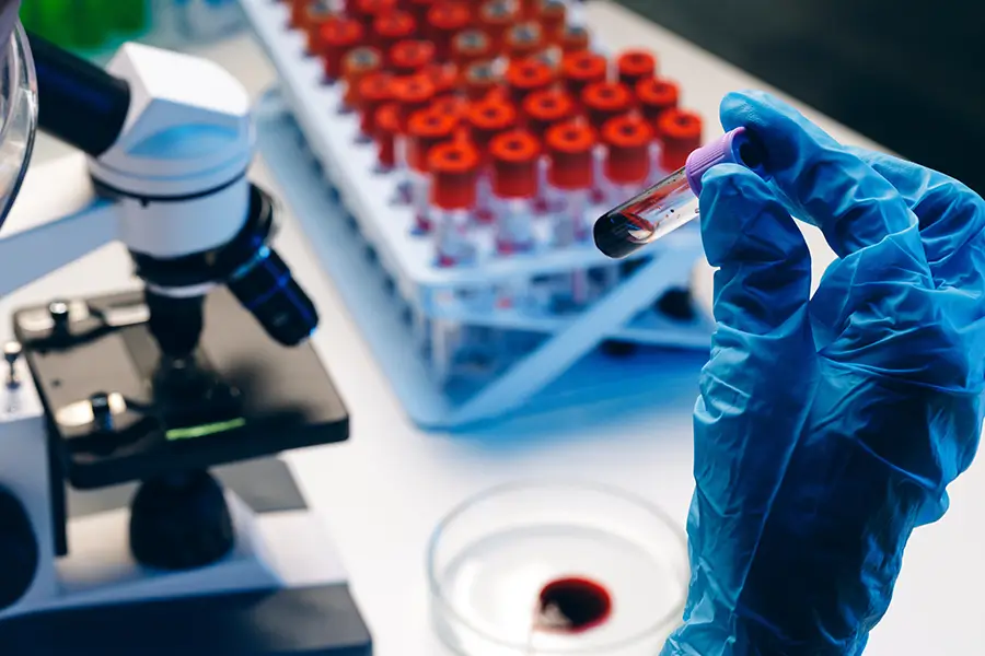 Chemical Tests in DUI Cases Breathalyzers and Blood Tests Chemical Tests in DUI Cases: Breathalyzers and Blood Tests